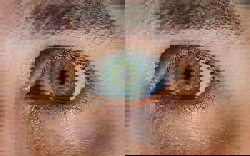 Close up photo of an eye