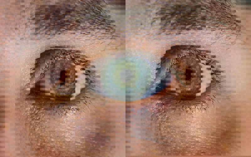 Close up photo of an eye